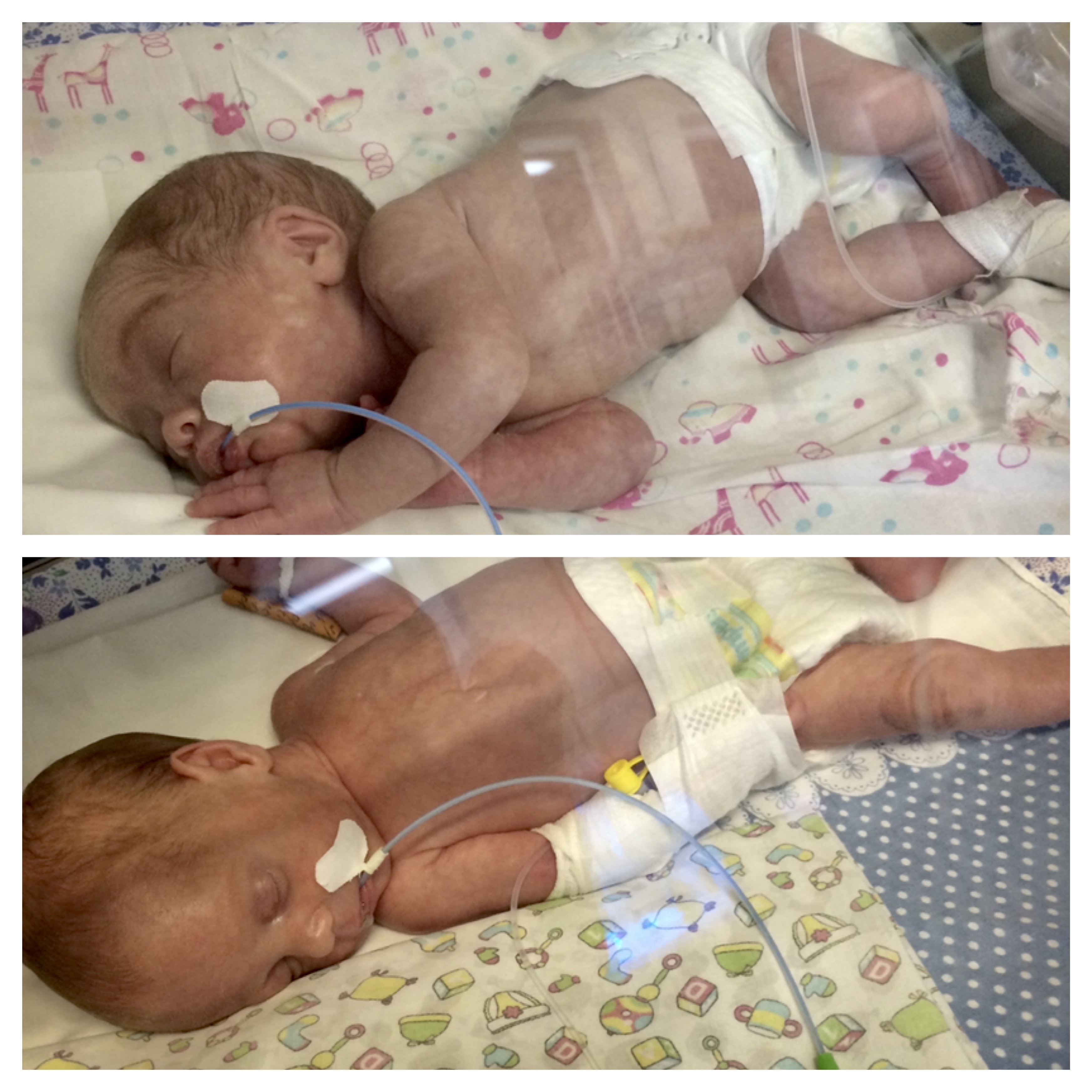 Наши малышки в реанимации